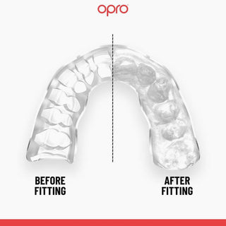 Paradenti Opro Instant Custom-Fit Gold Teeth-Combat Arena